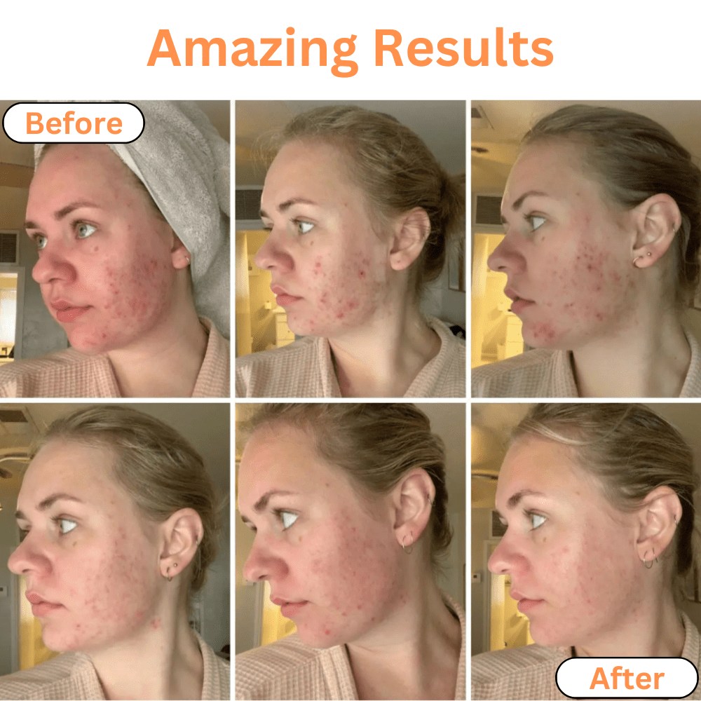 Just Like a Spa 5-in-1 Photon Skincare Wand - 40% OFF