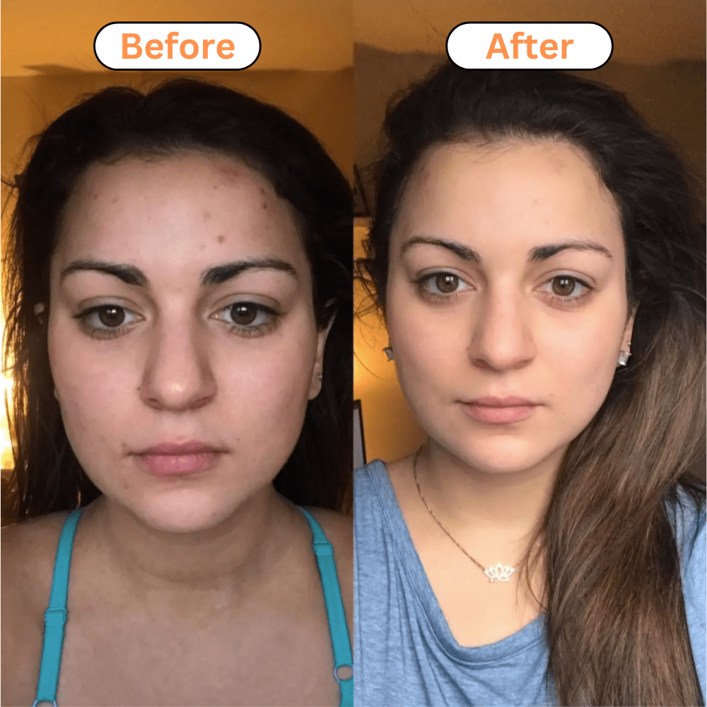 Just Like a Spa 5-in-1 Photon Skincare Wand - 40% OFF