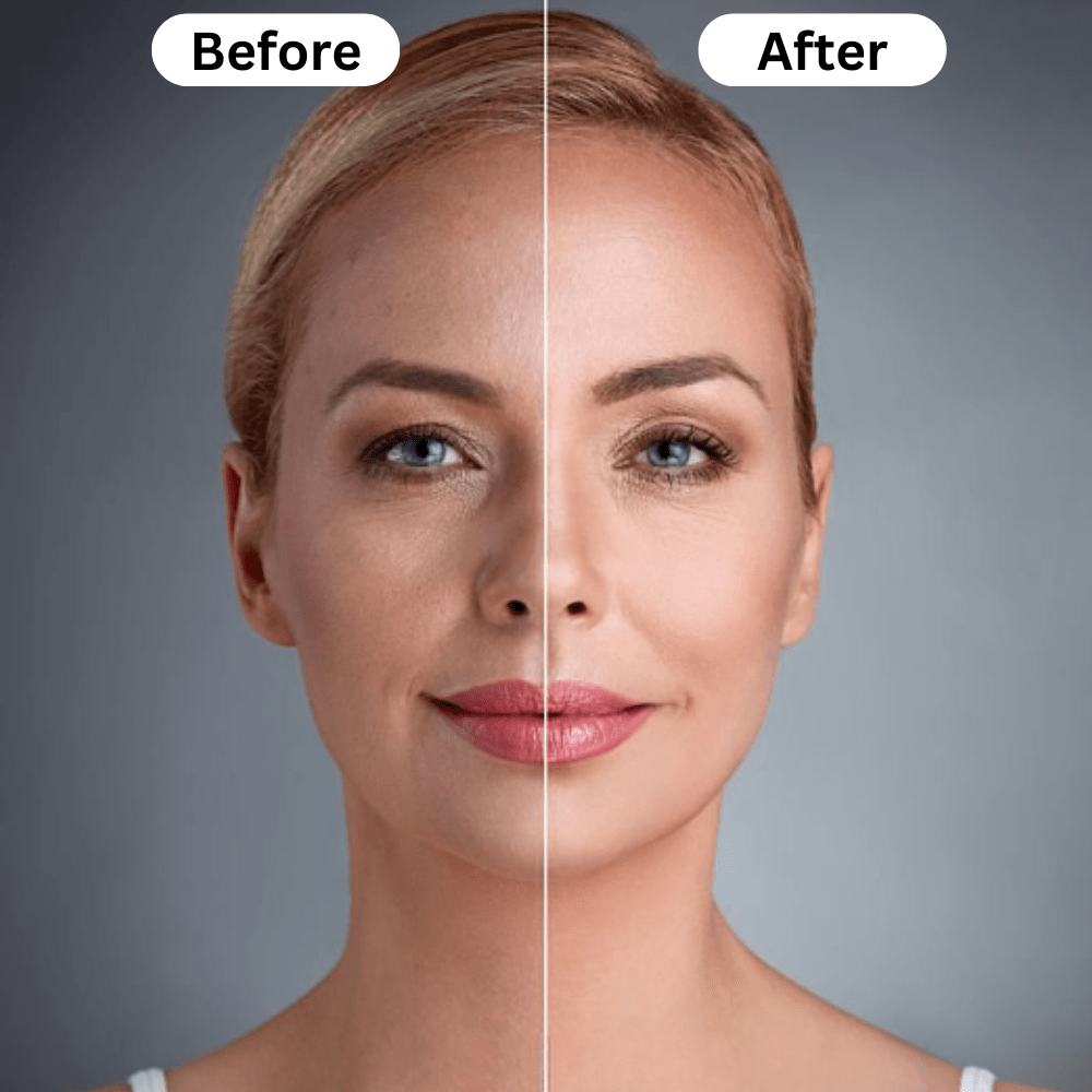 Just Like a Spa Photon Therapy Face Mask™️