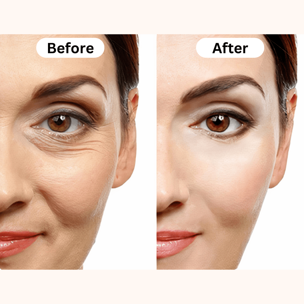 Just Like a Spa Photon Therapy Face Mask™️ - 50% OFF + FREE Gift