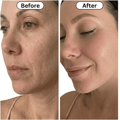 Just Like a Spa LED Beauty Face Mask Photon Therapy LED Face Mask™️